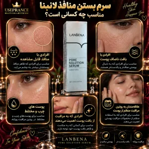 سرم بستن منافذ لانبنا مناسب چه کسانی است؟