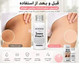 تاثیر لوسیون سفید کننده بیکینی مویام به روی پوست
