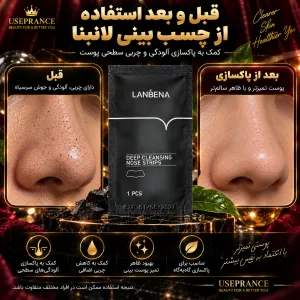 ایا چسب بینی ورقه ای تاثیر دارد؟