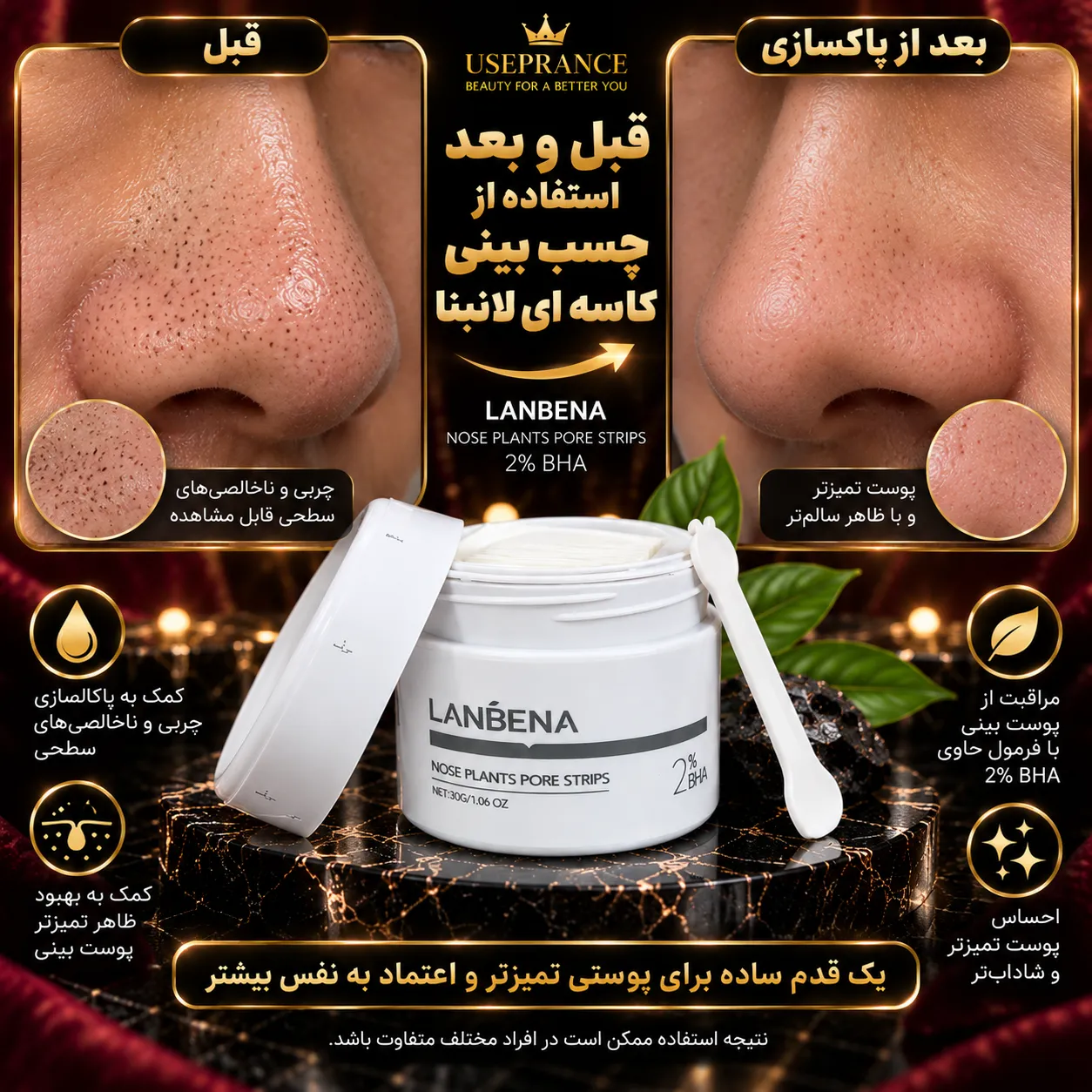 ایا چسب بینی کاسه ای لانبنا تاثیر دارد؟