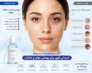 اثرات سرم هیالورونیک اسید بیواکوا به روی پوست