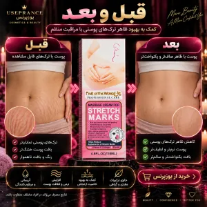 تاثیر کرم رفع ترک شکم ووکالی روی شکم