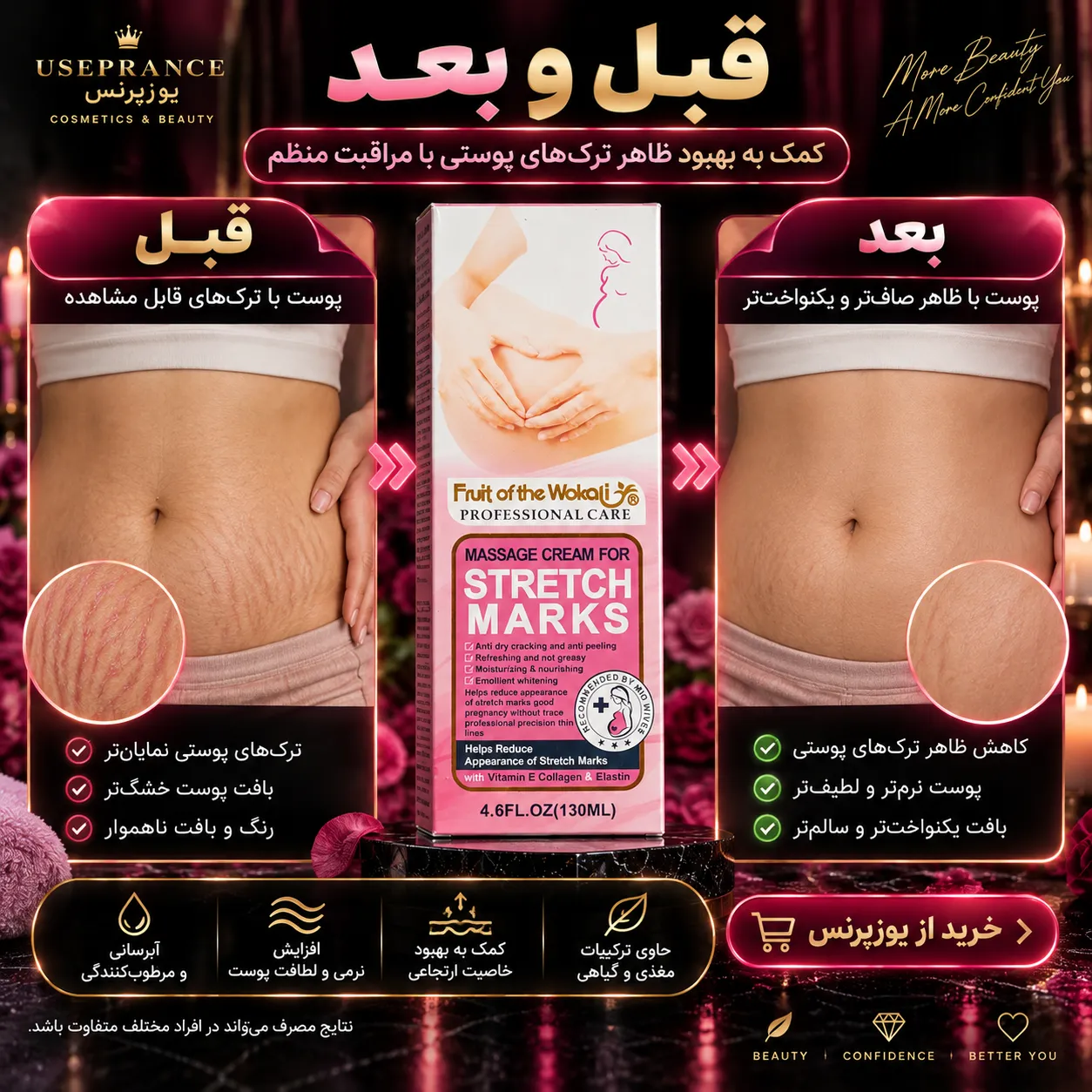 تاثیر کرم رفع ترک شکم ووکالی روی شکم