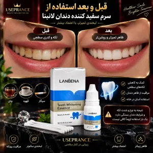 چگونه دندان هایمان را سفید کنیم؟