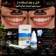 چگونه دندان هایمان را سفید کنیم؟